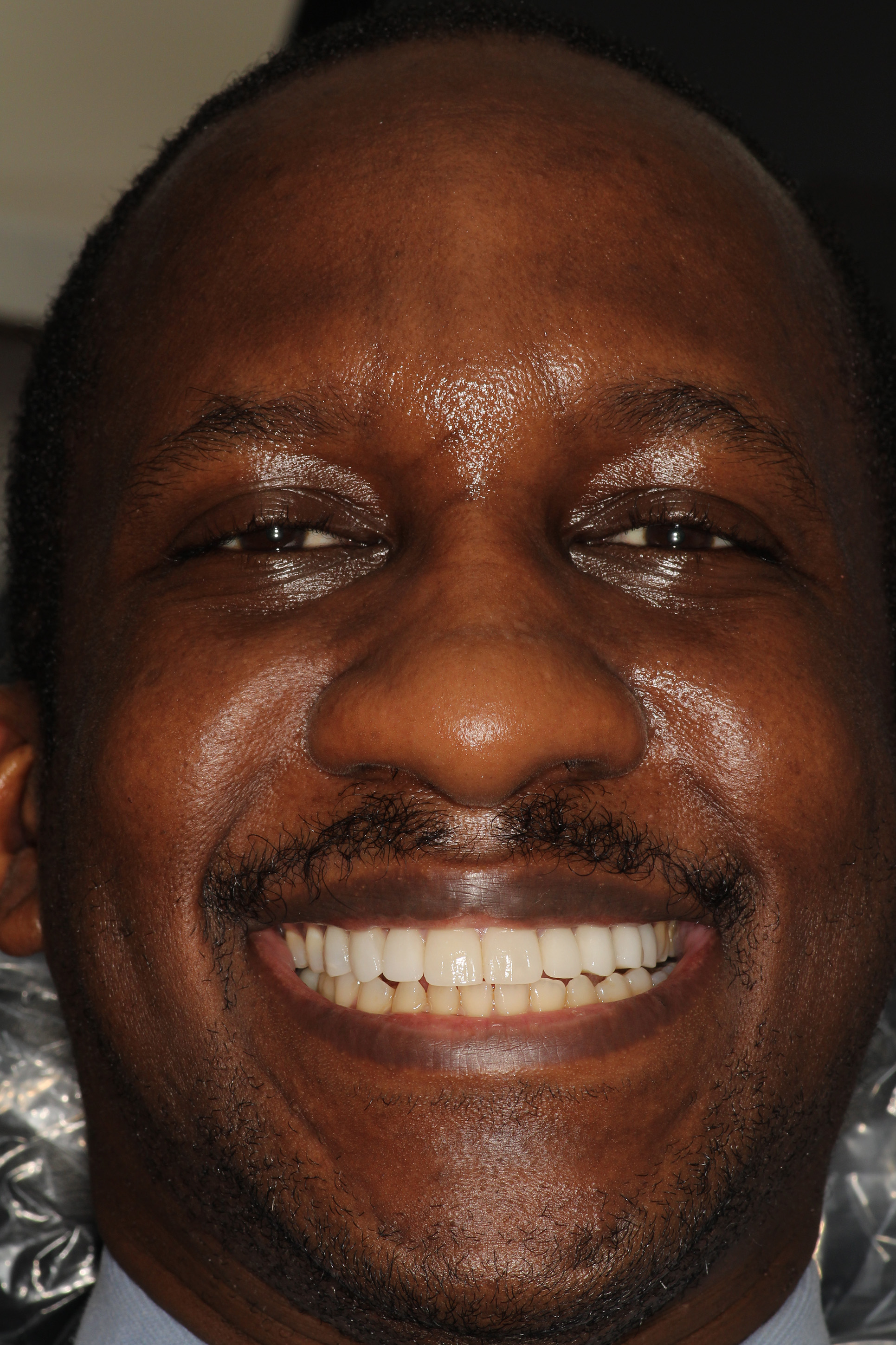 The image shows a man smiling at the camera with his mouth open, displaying white teeth. He appears to be indoors, possibly in an office setting, as suggested by the presence of what looks like a desk and computer equipment in the background.