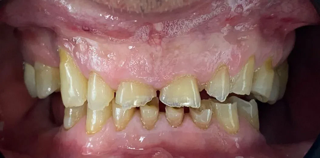 Chroma Dental | Sports Mouthguards, ClearCorrect reg  and Cosmetic Dentistry