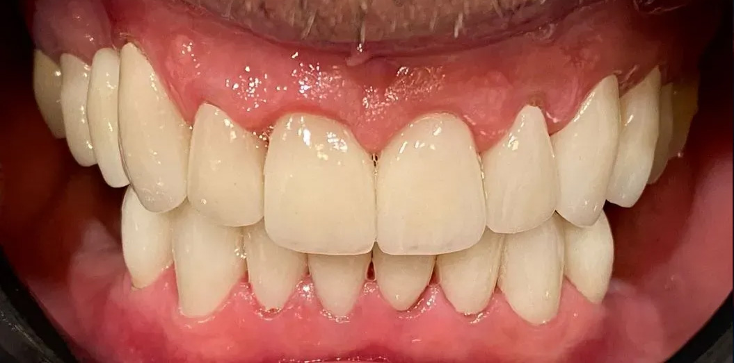 Chroma Dental | Intraoral Camera, Snoring Appliances and ClearCorrect reg 