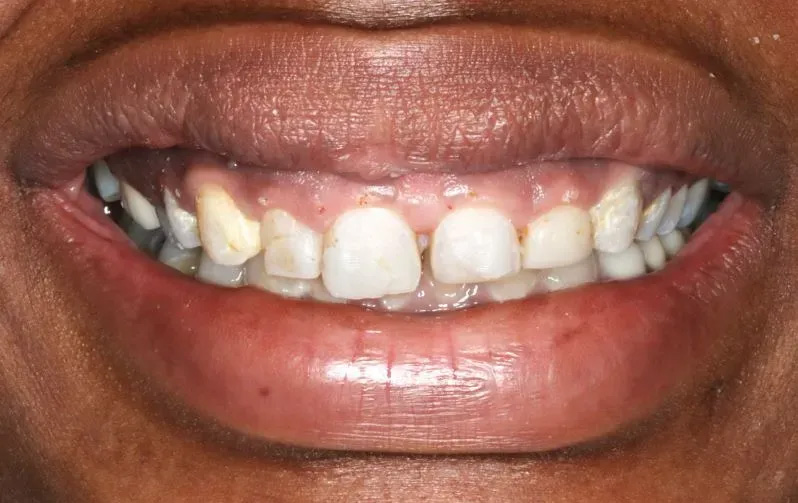 Chroma Dental | Teeth Whitening, Dental Fillings and Dental Cleanings