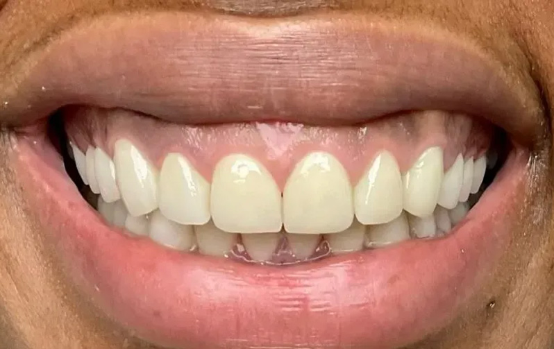 Chroma Dental | Digital Smile Design, Dental Sealants and CBCT