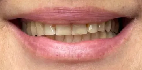 Chroma Dental | Implant Dentistry, Emergency Treatment and Dentures