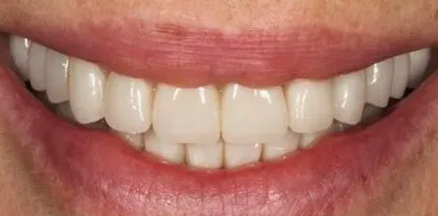 Chroma Dental | Family Dentistry, Clear and Ceramic Braces and Sports Mouthguards