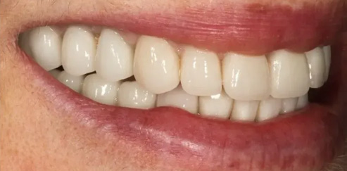 Chroma Dental | Dental Cleanings, Periodontal Treatment and Dermal Fillers