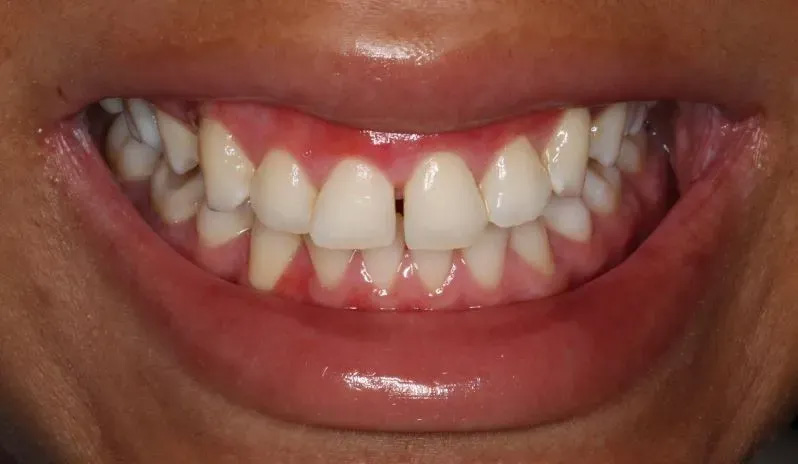 Chroma Dental | Implant Dentistry, Clear and Ceramic Braces and Family Dentistry