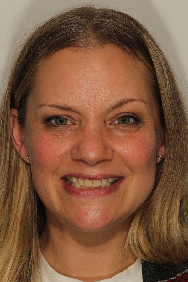 The image shows a woman with blonde hair smiling at the camera. She has a fair complexion and appears to be wearing makeup, including lipstick. Her attire consists of a patterned top with a darker background and lighter details. The woman s expression is cheerful, and she seems to be in good spirits.