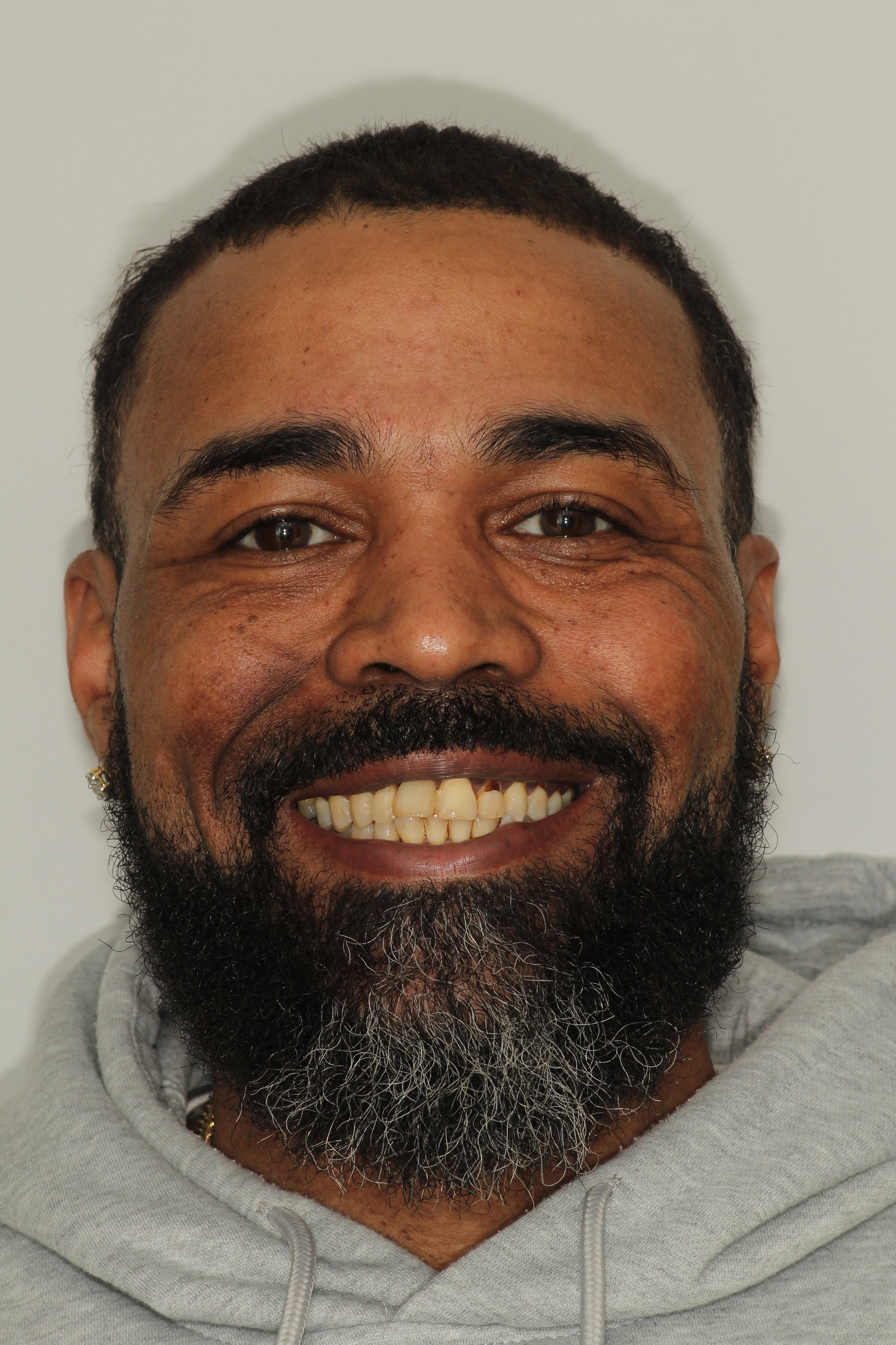 The image shows a smiling man with a beard, wearing a grey hoodie, against a white background.