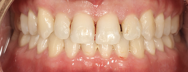Chroma Dental | Periodontal Treatment, TMJ Disorders and Dermal Fillers
