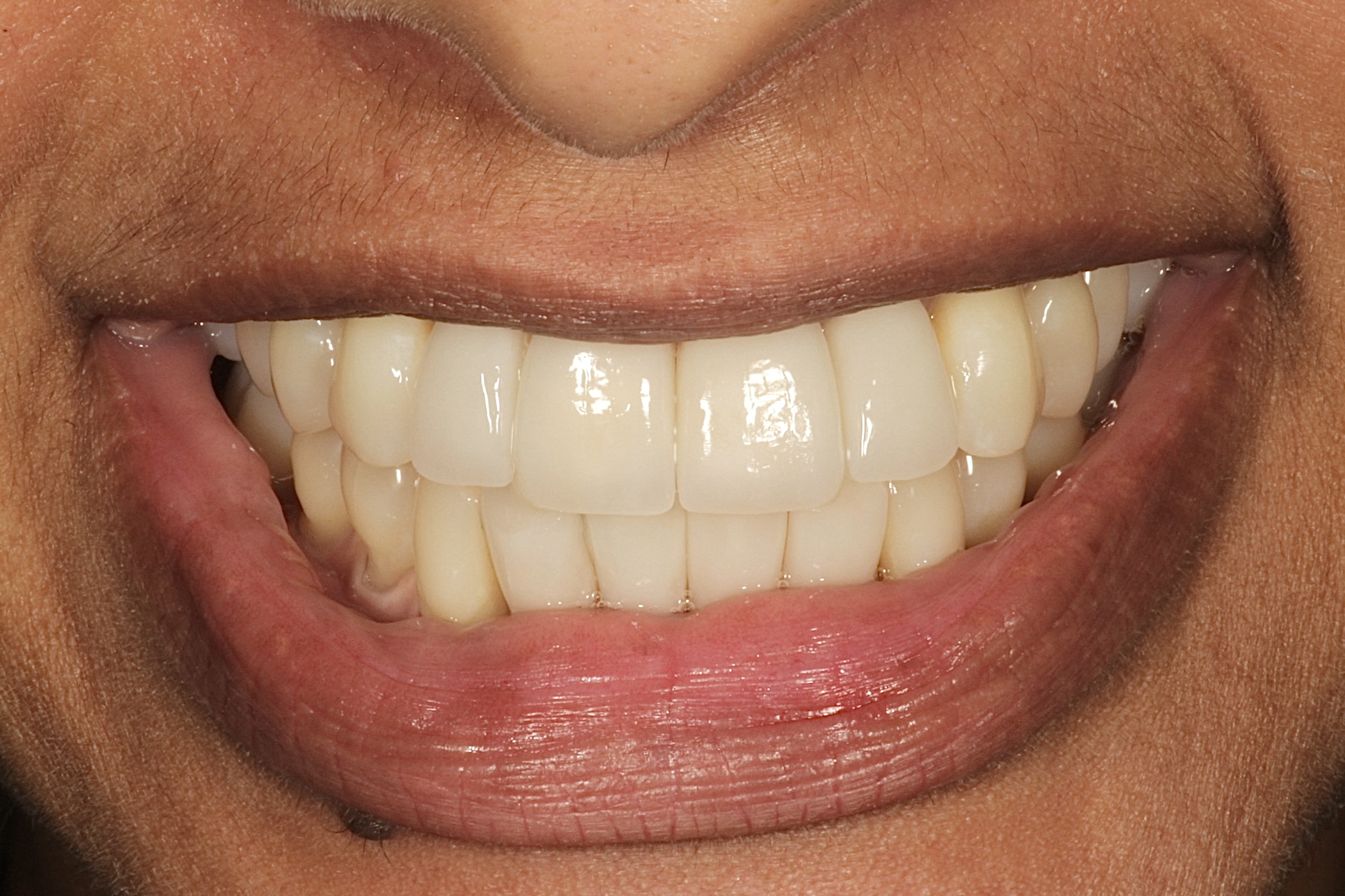 Chroma Dental | CEREC, Oral Surgery and Clear and Ceramic Braces