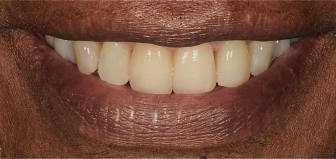 Chroma Dental | Oral Surgery, Root Canals and Oral Cancer Screening