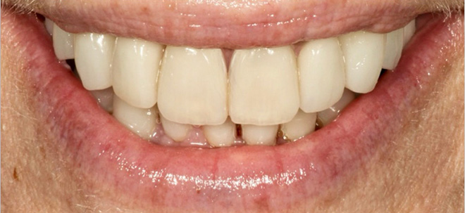 Chroma Dental | Invisalign reg , Clear and Ceramic Braces and TMJ Disorders