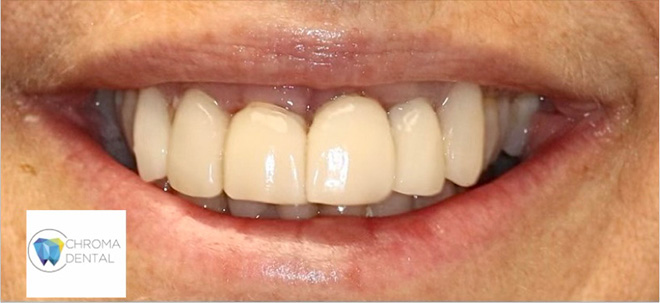 Chroma Dental | Intraoral Camera, Clear and Ceramic Braces and Sedation Dentistry