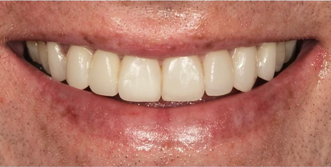 Chroma Dental | Dental Cleanings, Dental Bridges and Root Canals