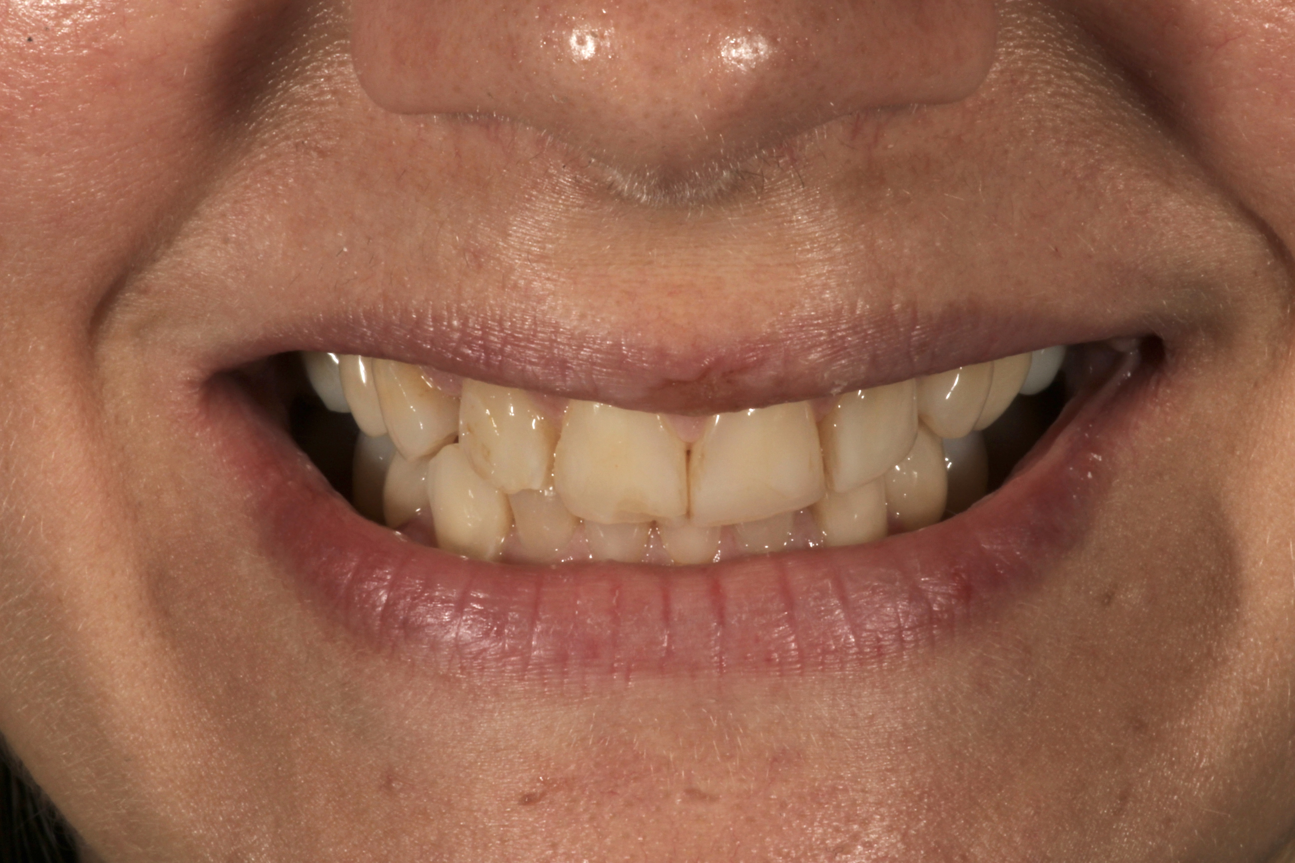 Chroma Dental | Dental Cleanings, Digital Smile Design and Laser Dentistry