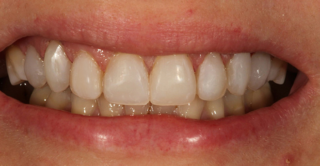 Chroma Dental | Teeth Whitening, TMJ Disorders and Dental Bonding