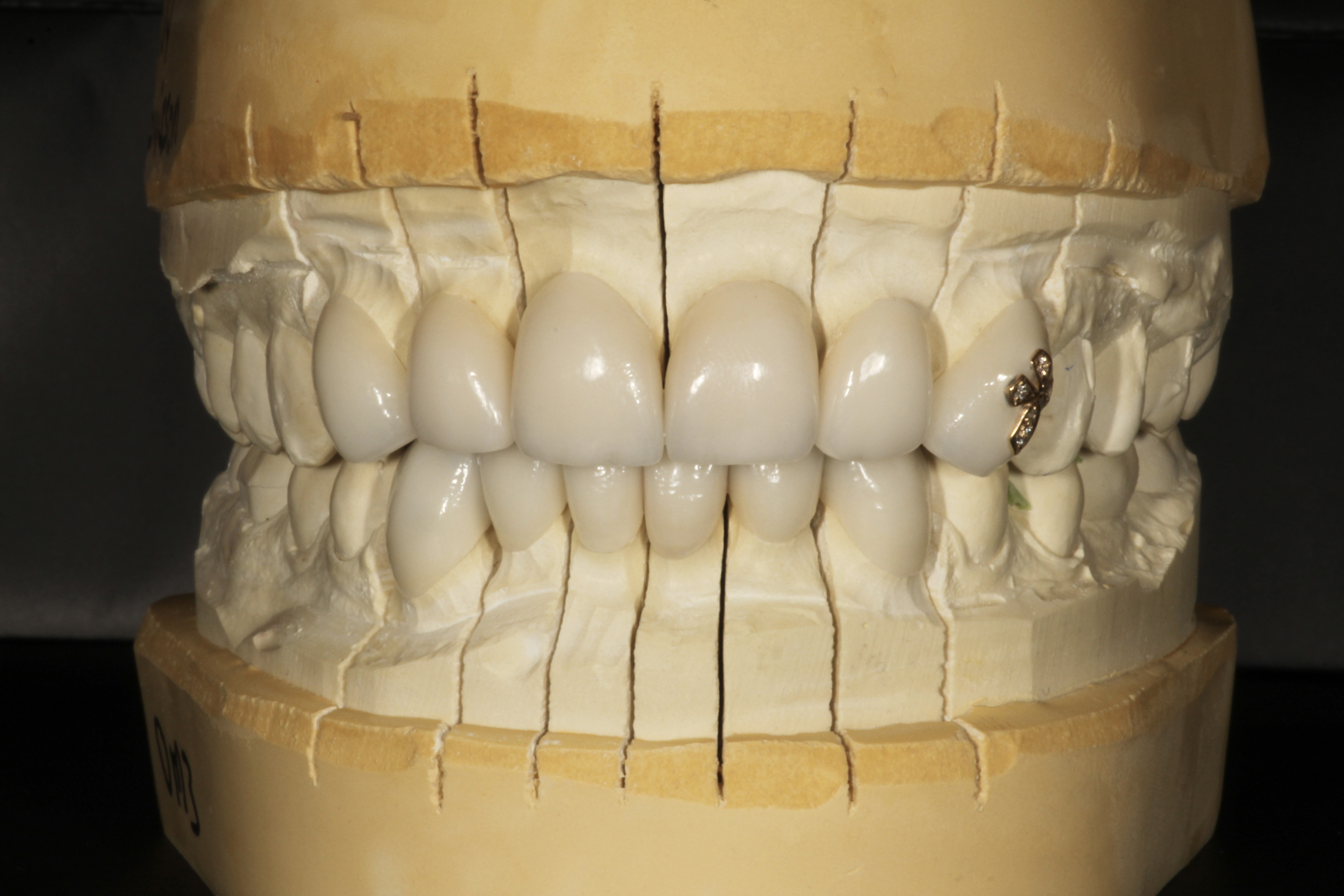 Chroma Dental | Laser Dentistry, Ceramic Crowns and ZOOM! Whitening