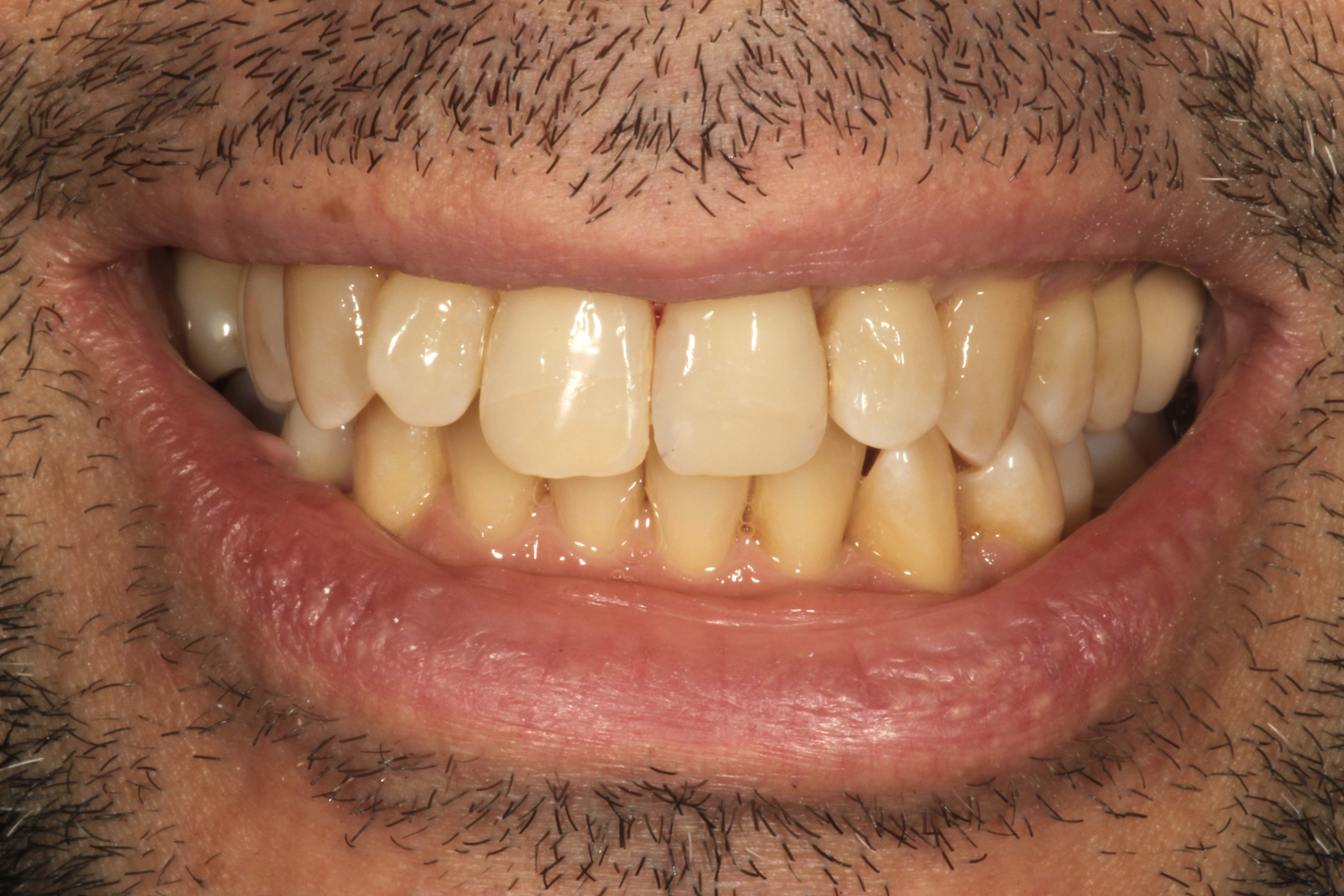 Chroma Dental | Invisalign®, Digital Radiography and Oral Cancer Screening