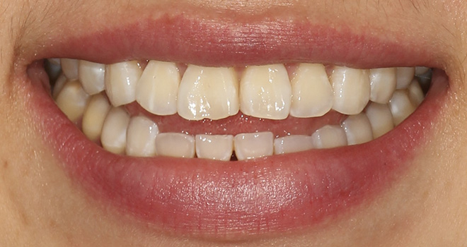 Chroma Dental | Wisdom Teeth, Root Canals and Oral Exams