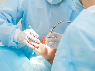 Chroma Dental | All-On-X  Teeth in a day , Juvederm reg  and Dental Sealants