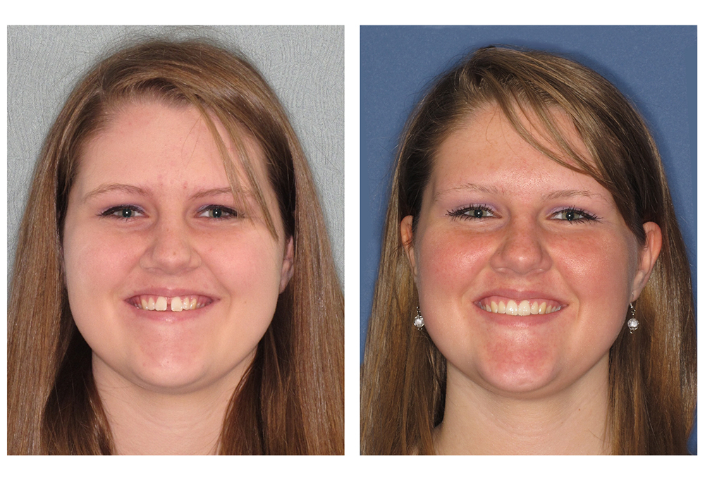 Chroma Dental