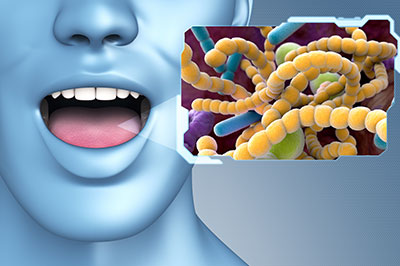 Chroma Dental | Dentures, Full Mouth Reconstruction and All-on-4 reg 