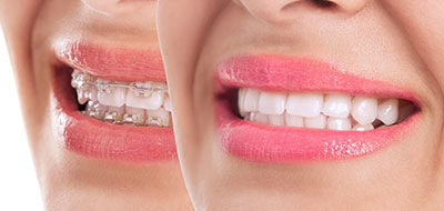 Chroma Dental | Extractions, Dental Fillings and TMJ Disorders