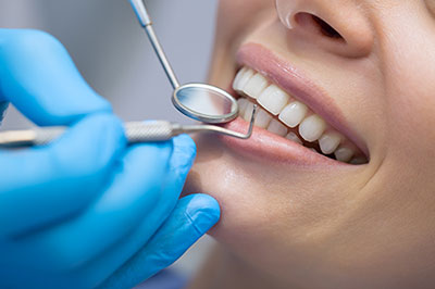 Chroma Dental | Fluoride Treatment, Oral Cancer Screening and Extractions