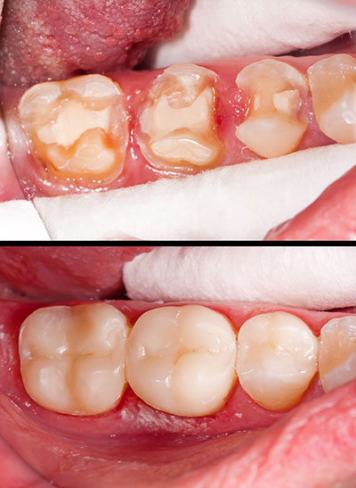 Chroma Dental | Anti-Aging Longevity Medicine, Family Dentistry and Sedation Dentistry
