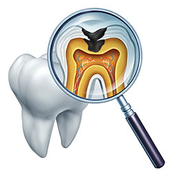 Chroma Dental | Dental Bonding, Family Dentistry and Cosmetic Dentistry