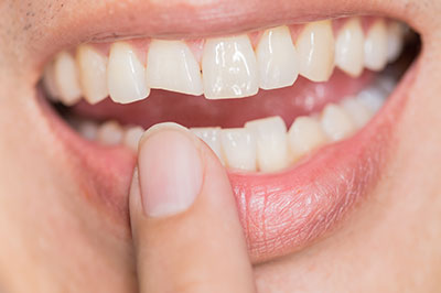 Chroma Dental | CBCT, CEREC and Emergency Treatment