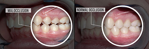 Chroma Dental | Digital Radiography, Cosmetic Smile Makeover and Dental Fillings