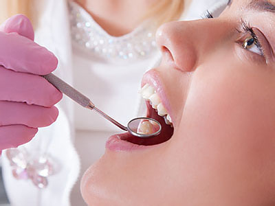 Chroma Dental | Dental Bridges, ZOOM  Whitening and Sports Mouthguards
