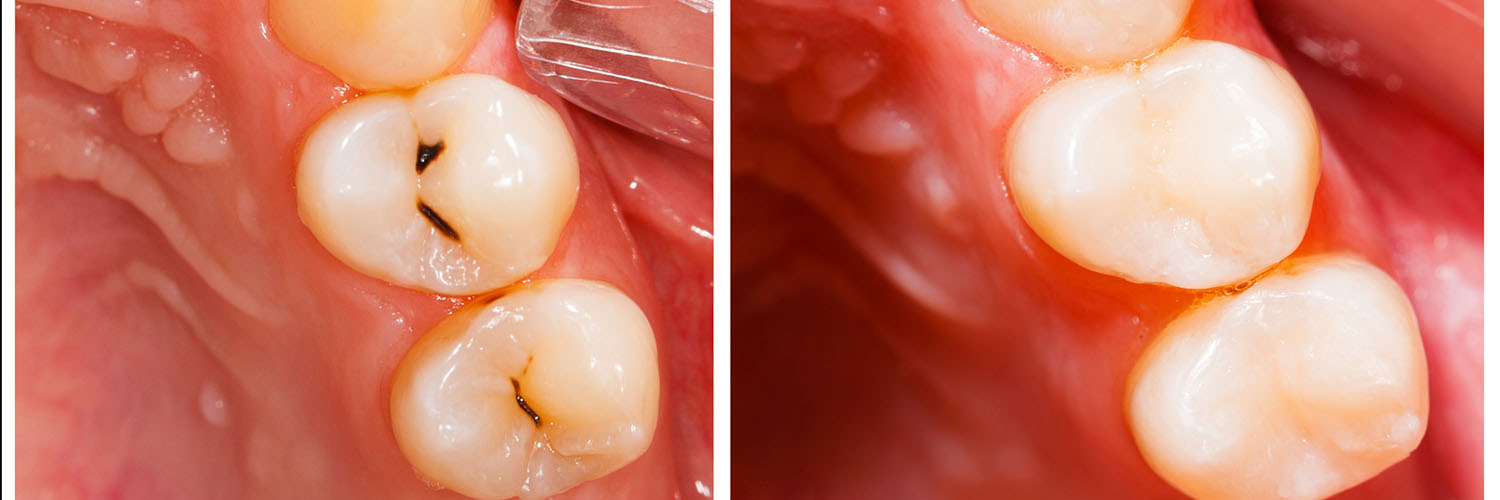 Chroma Dental