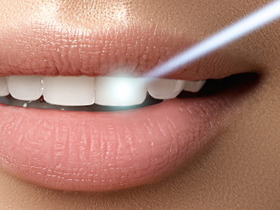 Chroma Dental | Dental Sealants, Implant Dentistry and Anti-Aging Longevity Medicine